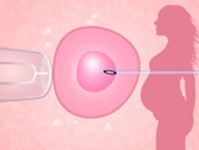Does IVF increase a woman’s risk for breast cancer?