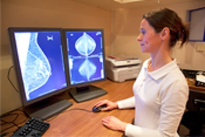 Breast cancer screening should be tailored to a woman’s risk factors and breast density