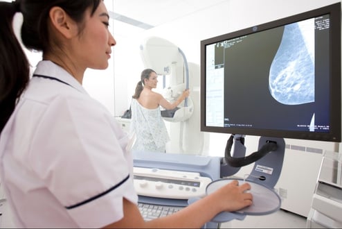 Artificial intelligence (AI) may find breast cancer on mammograms sooner