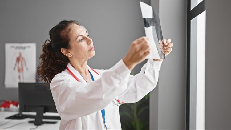 El tratamiento para reducir las fracturas óseas también mejora la supervivencia al cáncer de mama en personas posmenopáusicas