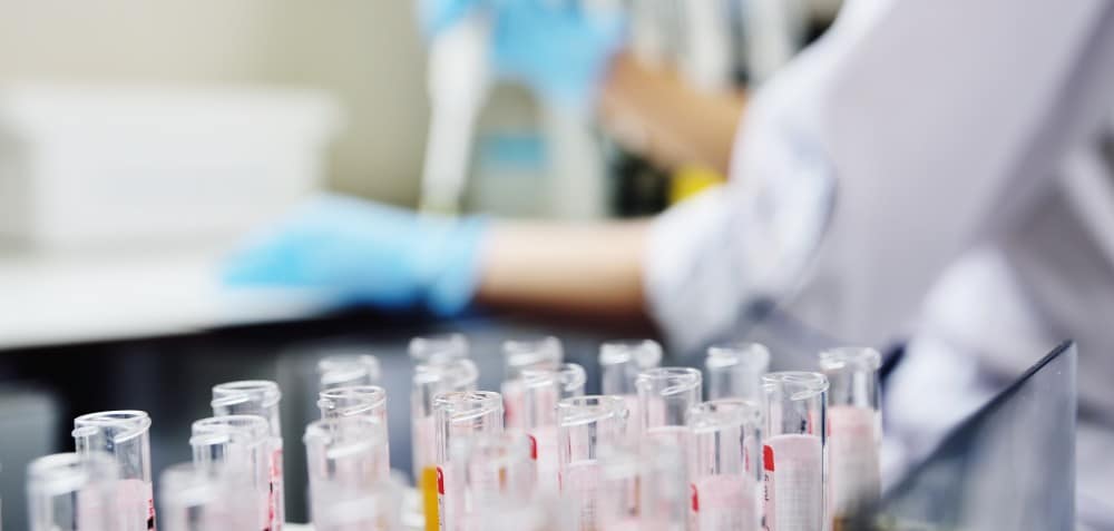 Genetic Testing Results In An Early Stage Ovarian Cancer Diagnosis