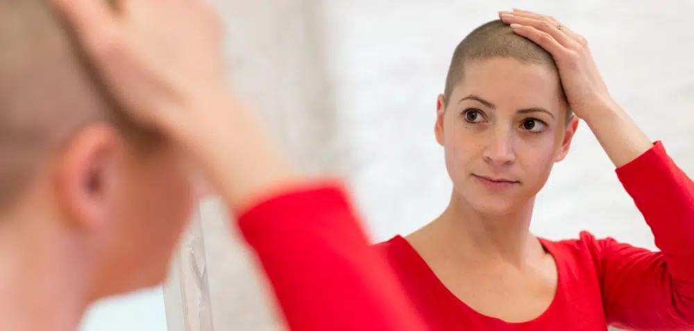 Chemo and Hair Loss Is More Than a Vanity Issue