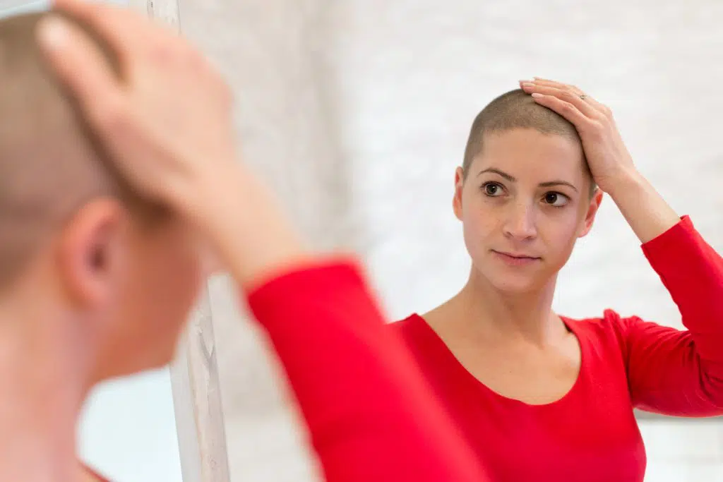 Chemo and Hair Loss Is More Than a Vanity Issue