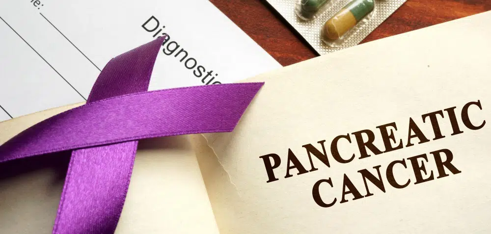 New PARP Inhibitor Approval for Pancreatic Cancer