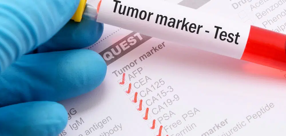New Medicare Genetic Testing Policy: What Does It Mean to Me?