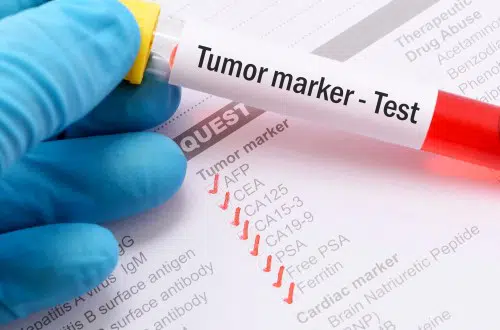 New Medicare Genetic Testing Policy: What Does It Mean to Me?