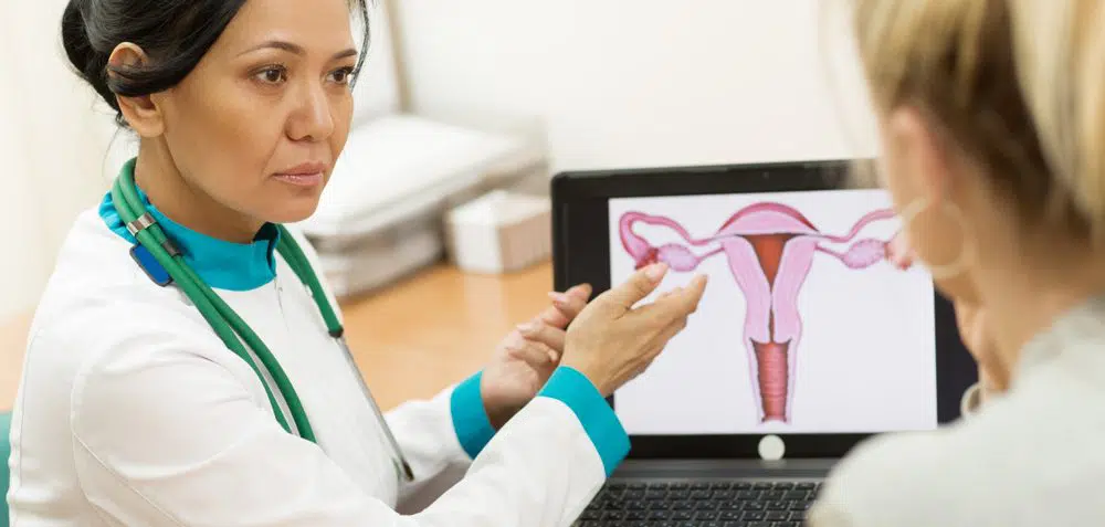How Do Women Decide Whether Or Not To Remove Their Uterus During BSO?