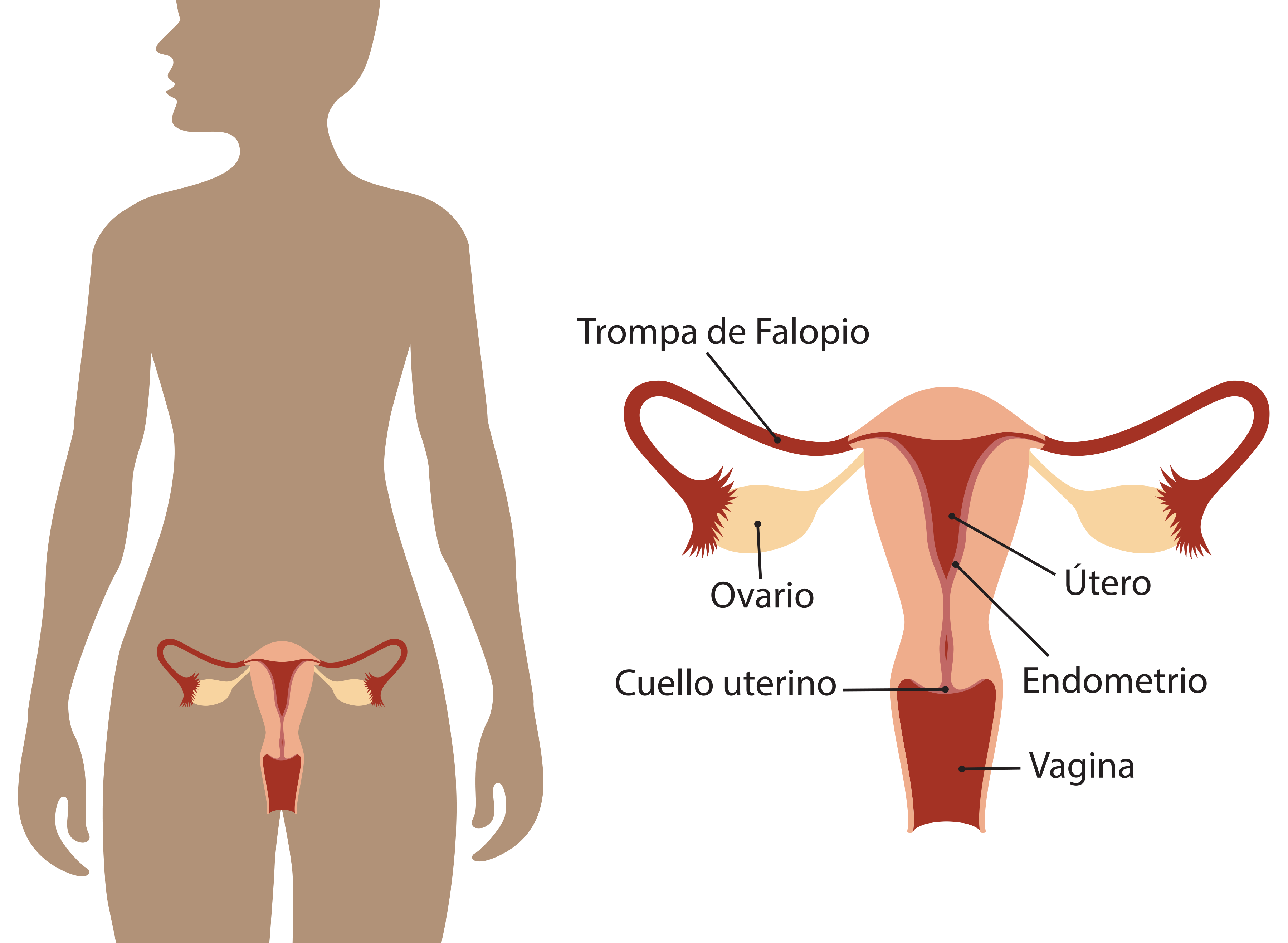 SALPINGOOFORECTOMIA (CIRUGÍA DE EXTIRPACIÓN DE OVARIOS) – Cirugía